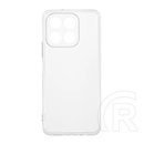 Gigapack Honor X7d 4G  szilikon telefonvédő (ultravékony) átlátszó