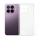 Gigapack Xiaomi 17T Pro szilikon telefonvédő (ütésállóság, légpárnás sarok) átlátszó