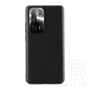 Joyroom Star Lord Huawei P40 műanyag telefonvédő (ultravékony, fém kameravédő keret bevonat) fekete