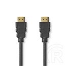 Nedis CVGL35000BK10 ultra HDMI 2.1 kábel 1 m (48 Gbps, 8K@60Hz, fekete)